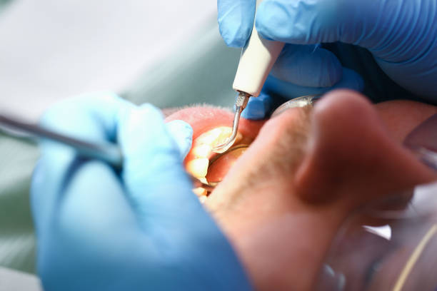 Best Walk-In Emergency Dentist in New Hope, MS